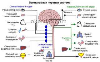 Основные симптомы всд