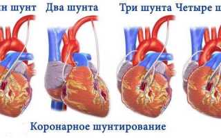 После операции на сердце