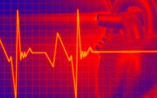Почему сердце начинает сильно биться без причины