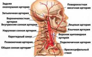 Брахиоцефальные артерии это