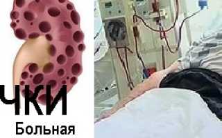 Лечение хронической почечной недостаточности — Лечение болезней внутренних органов. Том 2