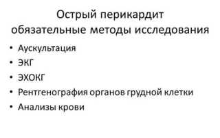 Острый перикардит