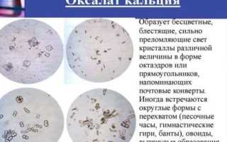 Анализ мочи на соли: оксалаты и фосфаты, суточный, общий и другие