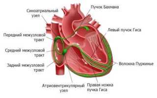 Неполная блокада пнпг