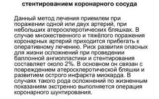Стенд в сосуде сердца