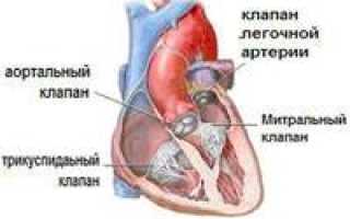 Пролапс сердечного клапана