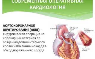 Шунтирование сердца что это такое