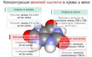 Высокий уровень мочевой кислоты в крови и моче – значение